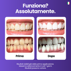 Purple Whitening Strips