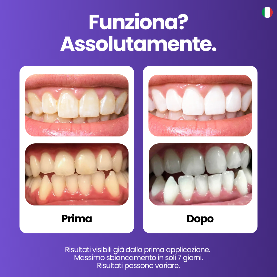 Purple Whitening Strips